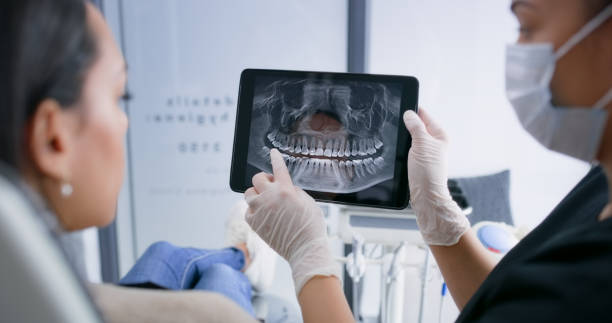 Licensed Teeth Whitening service in Butte, MT - Smile Center Dentistry